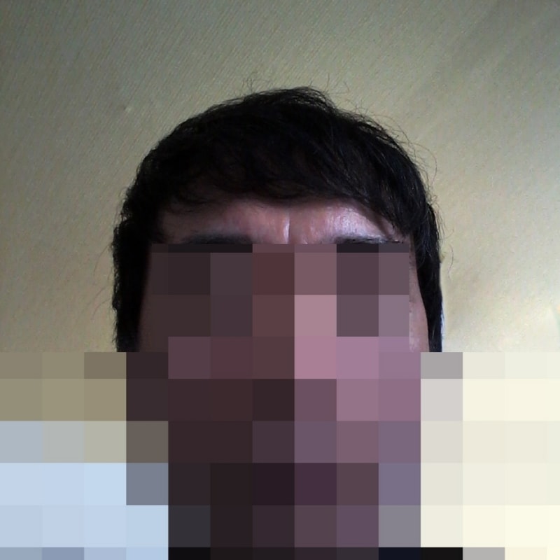 [正常な回復 1年以上~大茶母を飲みに来ました]。 頑張ってください~]