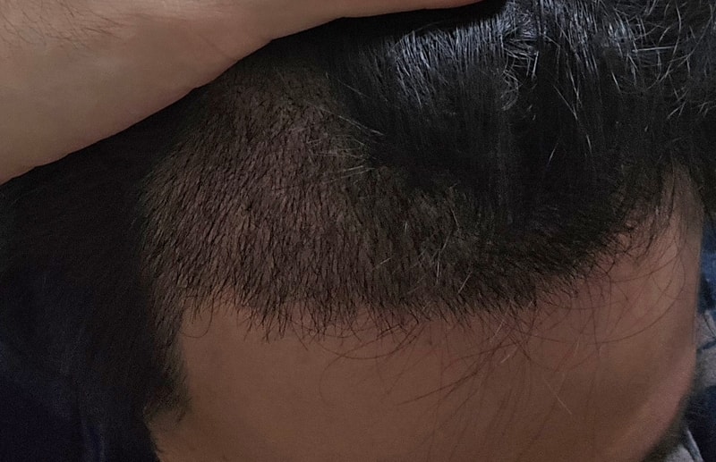 이식 17일차-2.jpg