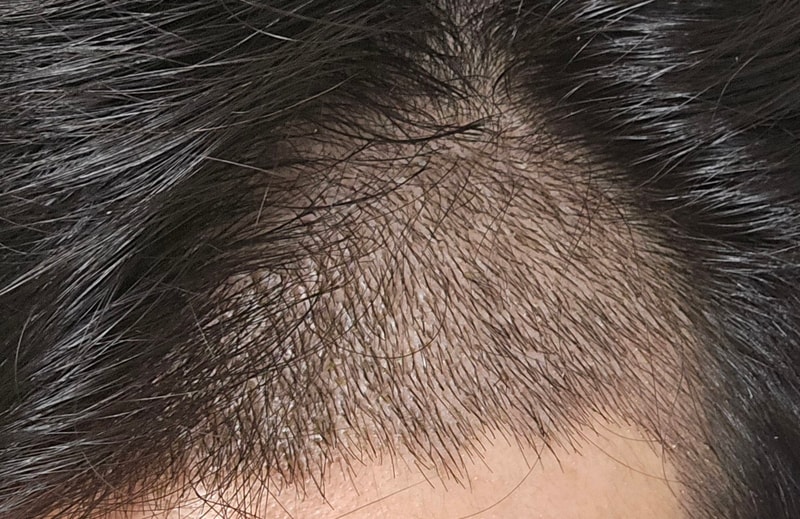 이식 10일차-2.jpg