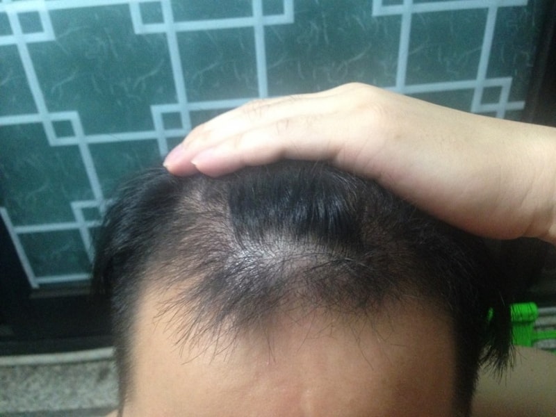 KakaoTalk_20170731_004721824.jpg