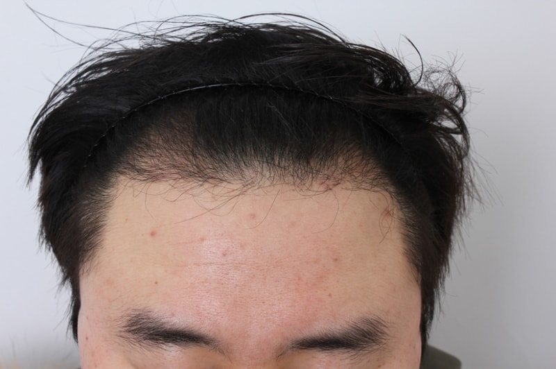 6개월 M.JPG