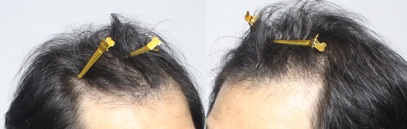KakaoTalk_20220125_164101589_01.png