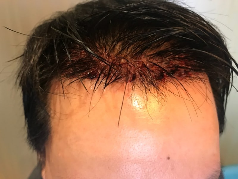 KakaoTalk_20180906_133656690.jpg