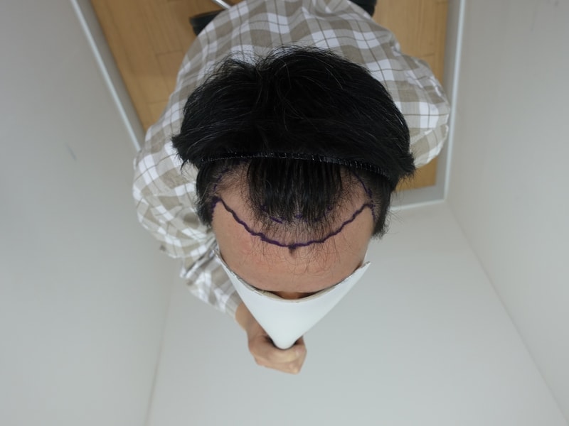 2월2일 수술전03.jpg