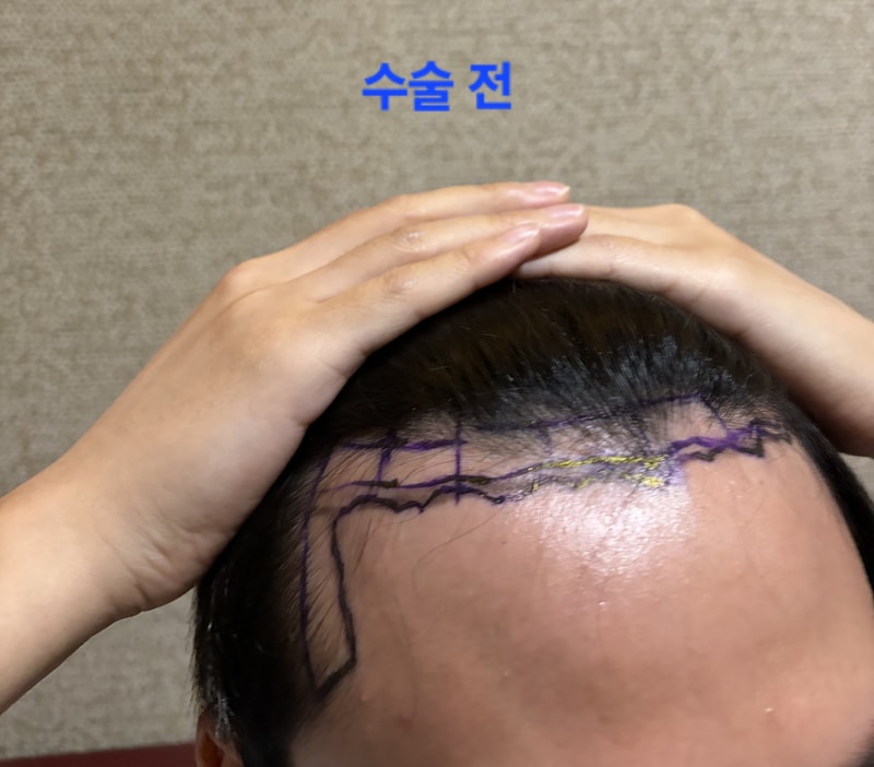 포토후기 이미지