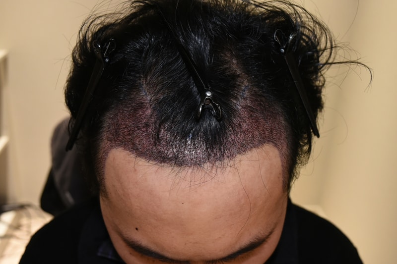 1일차샴프.jpg