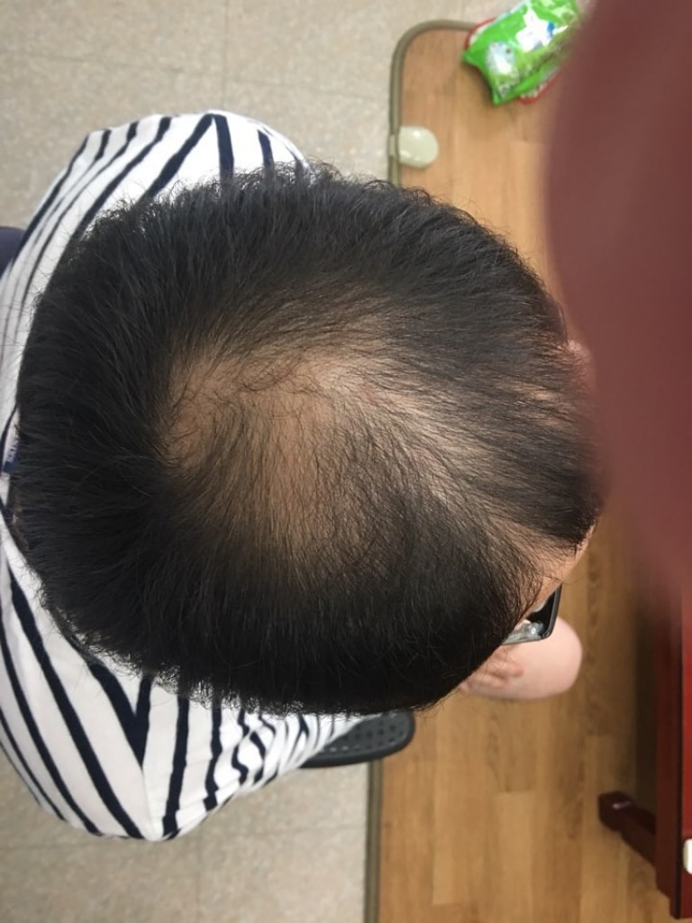 전.jpg