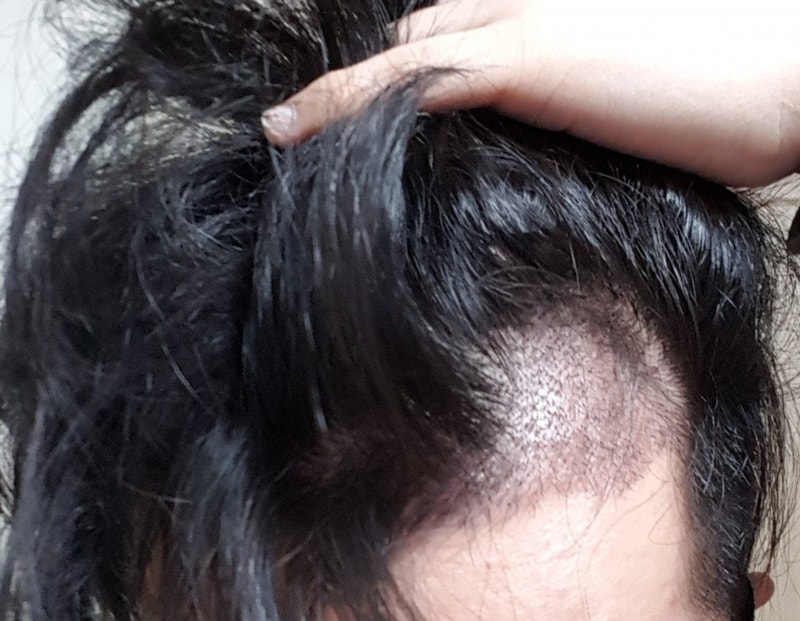 20170329_185337.jpg