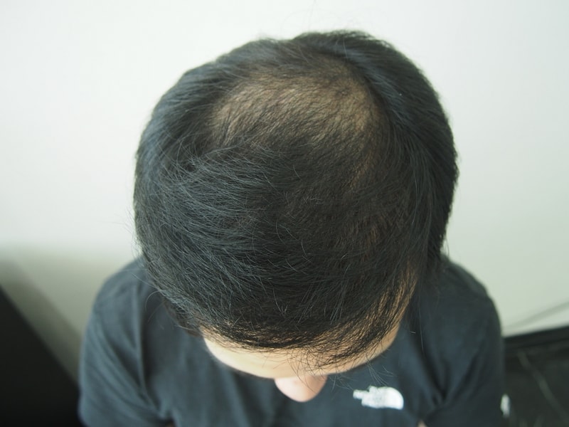 P8100011.JPG