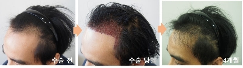 좌측.jpg