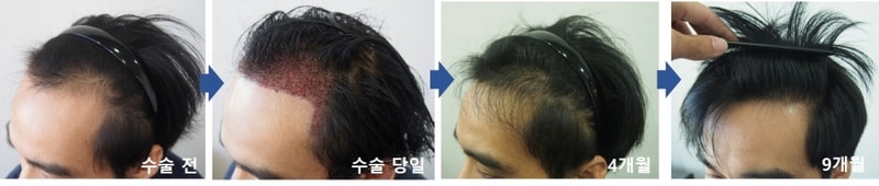 좌측9.jpg