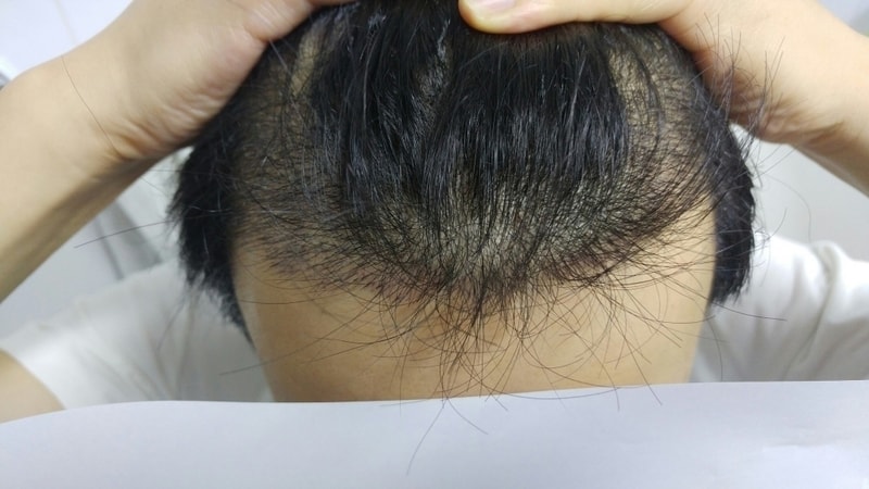 20180113_223149.jpg