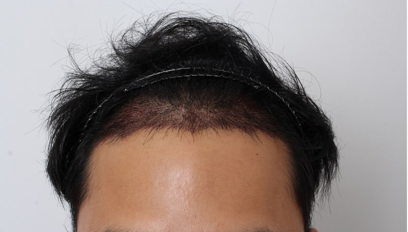 수술당일.jpg
