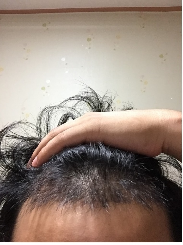 25일째.jpg