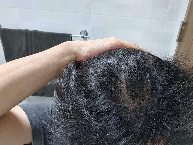 정수리1.jpg