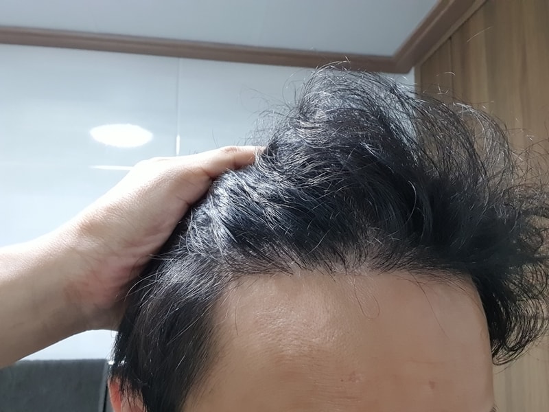 앞머리2.jpg