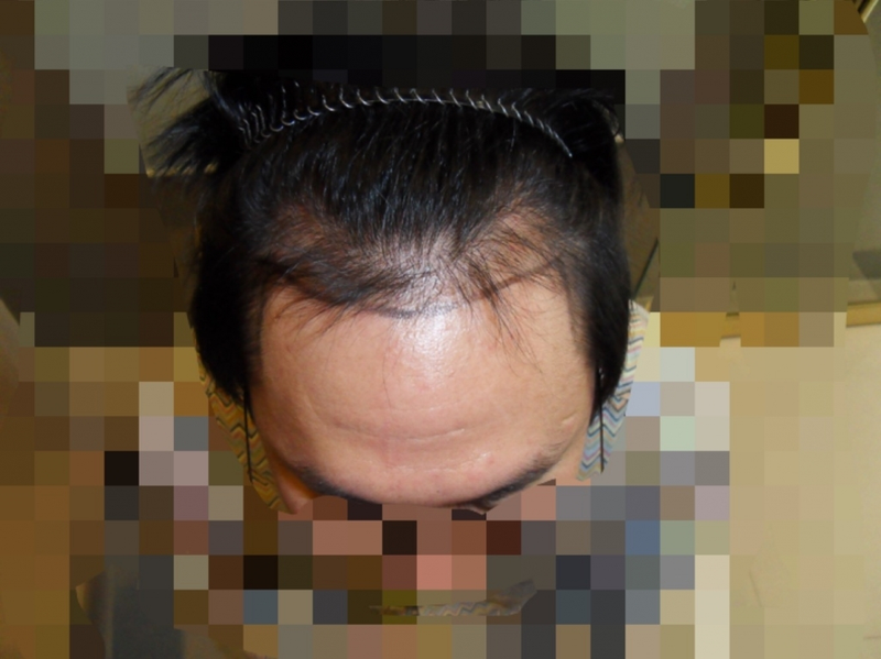 2.PNG