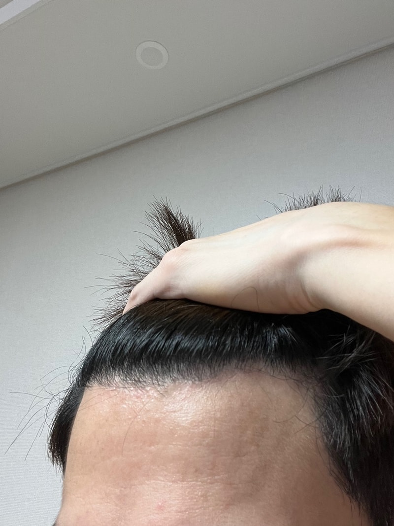 6개월 후기입니다.