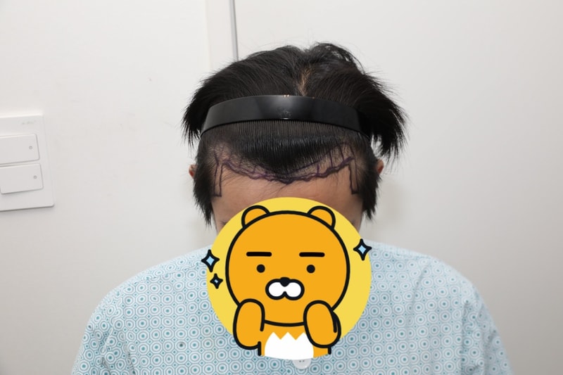 수술전2.jpeg