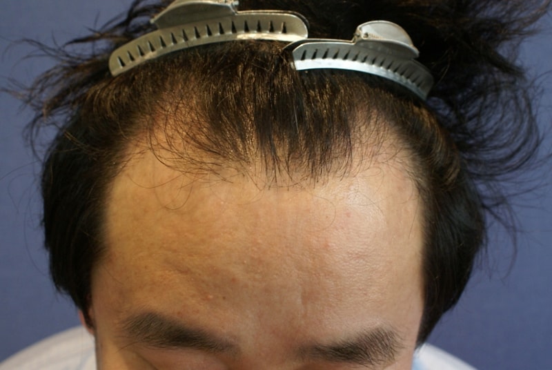 opDSC03121.JPG