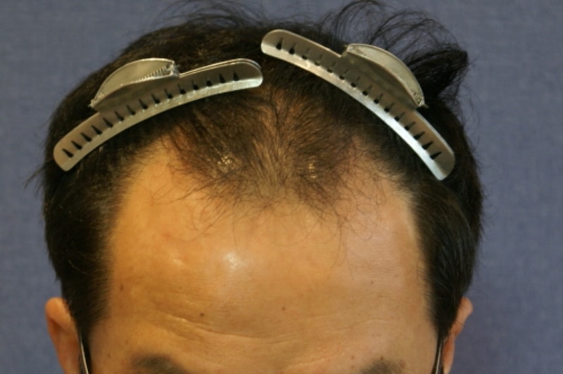 opDSC06771.JPG