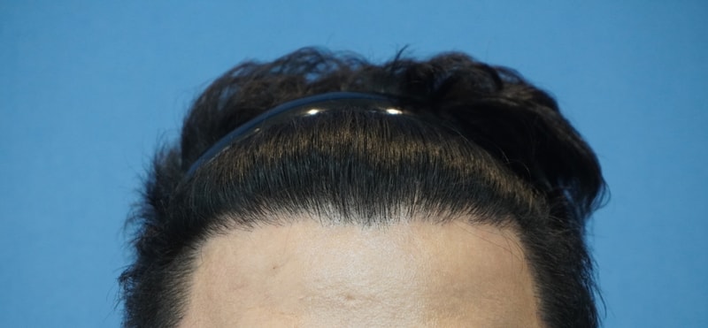 수술전.jpg