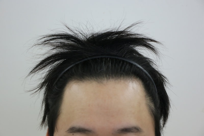 수술전.JPG