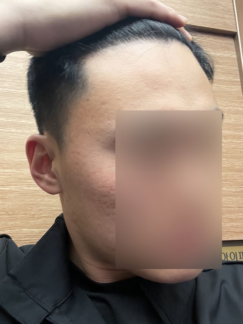 후1.jpg