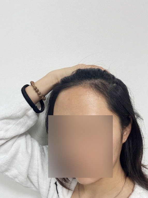 후-3.jpg