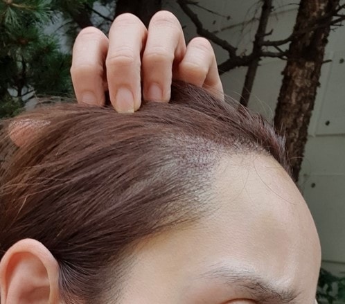 수술후_03.jpg
