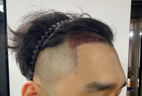 수술후_03.jpg