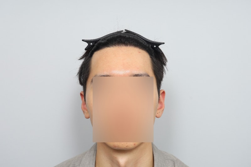 후4.jpg