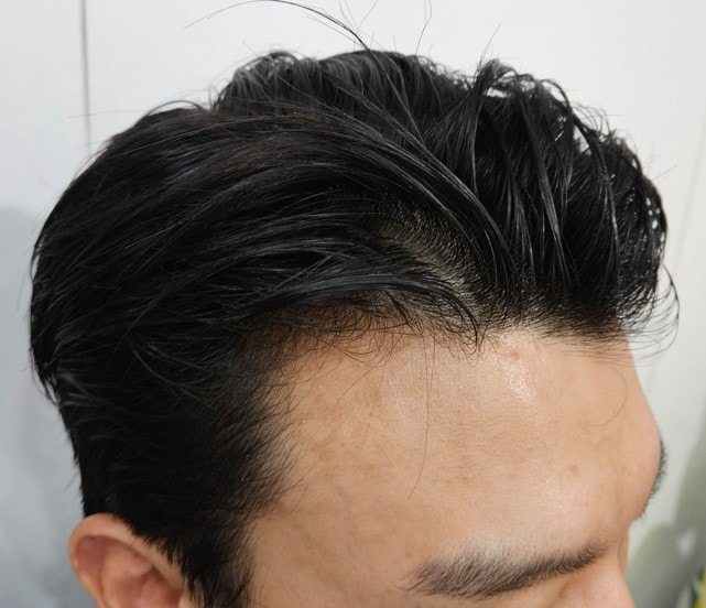 수술전02.jpg