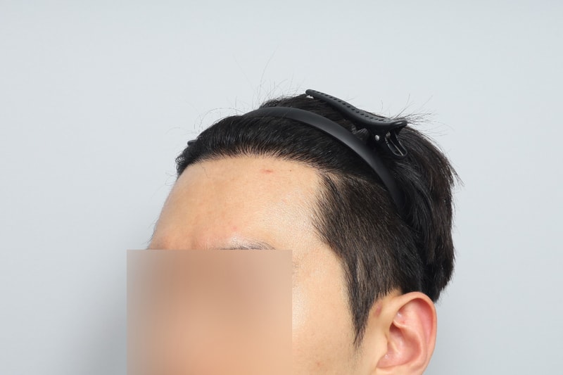 후2.jpg