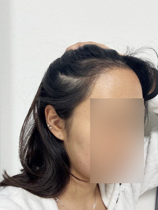 후-5.jpg