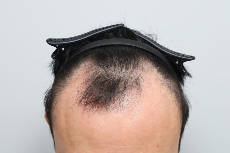 포토후기 이미지