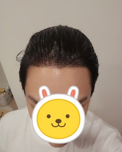 후2.jpg