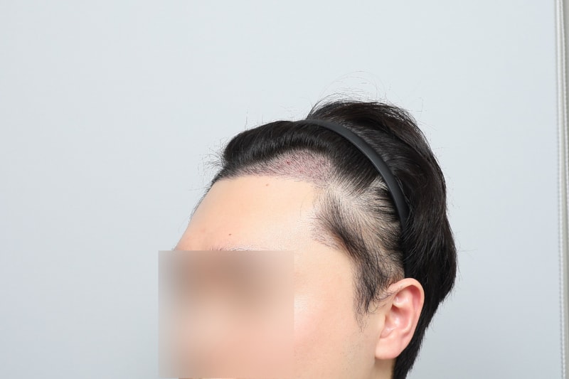 후3.jpg