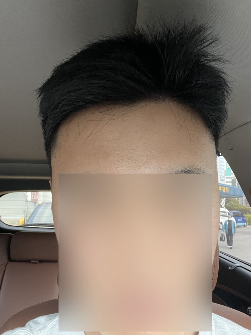 후2.jpg