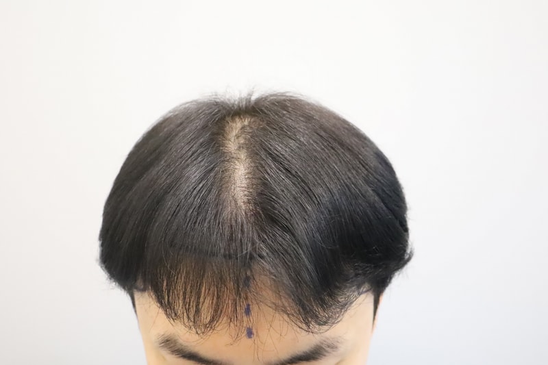 수술전디자인 21.jpg