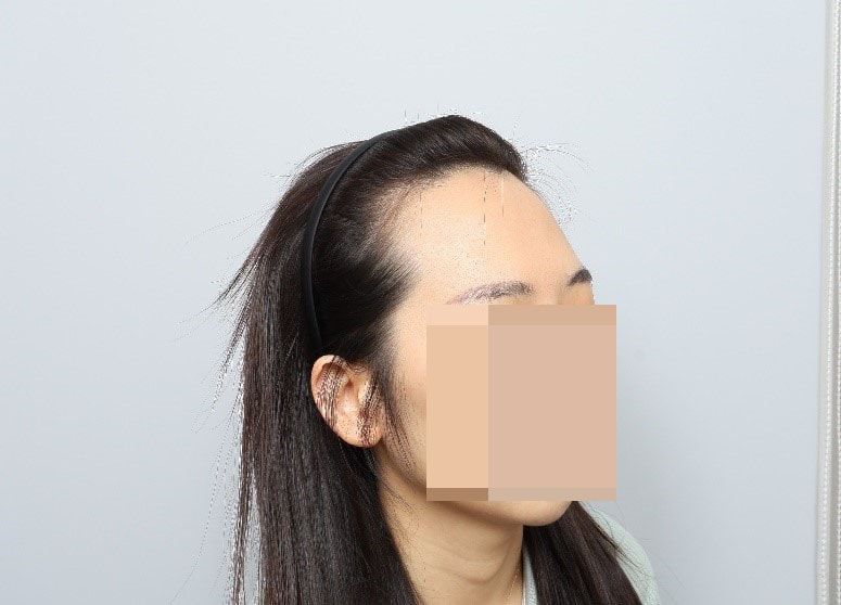 전2.jpg