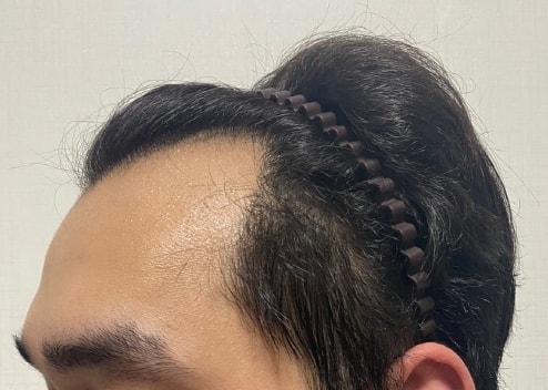 수술전_02.jpg
