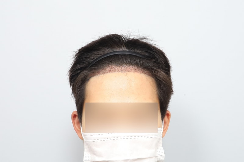 후5.jpg