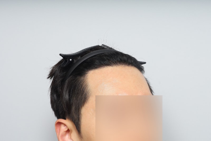 후6.jpg