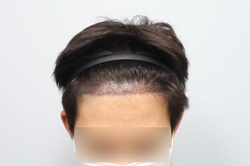 후1.jpg