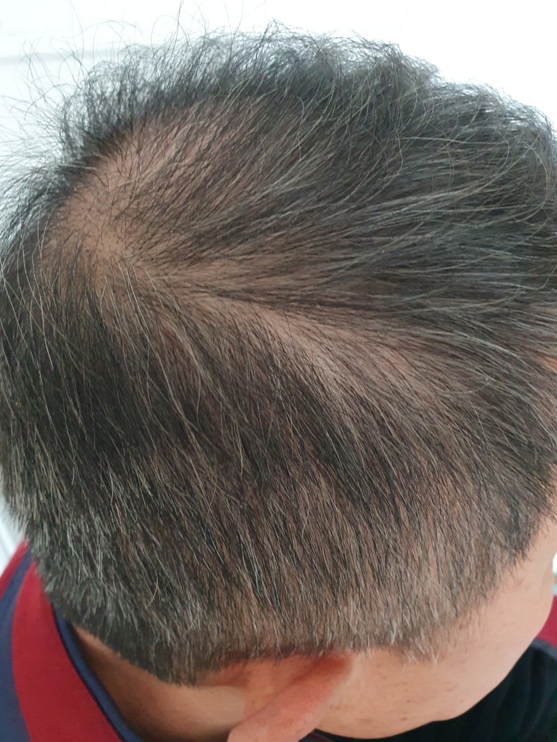 KakaoTalk_Photo_2025-03-13-13-42-55_12_.jpg