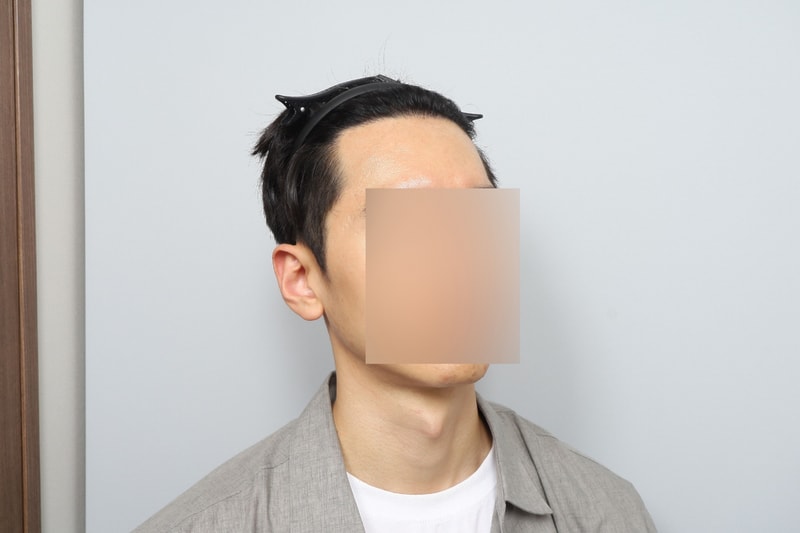 후1.jpg