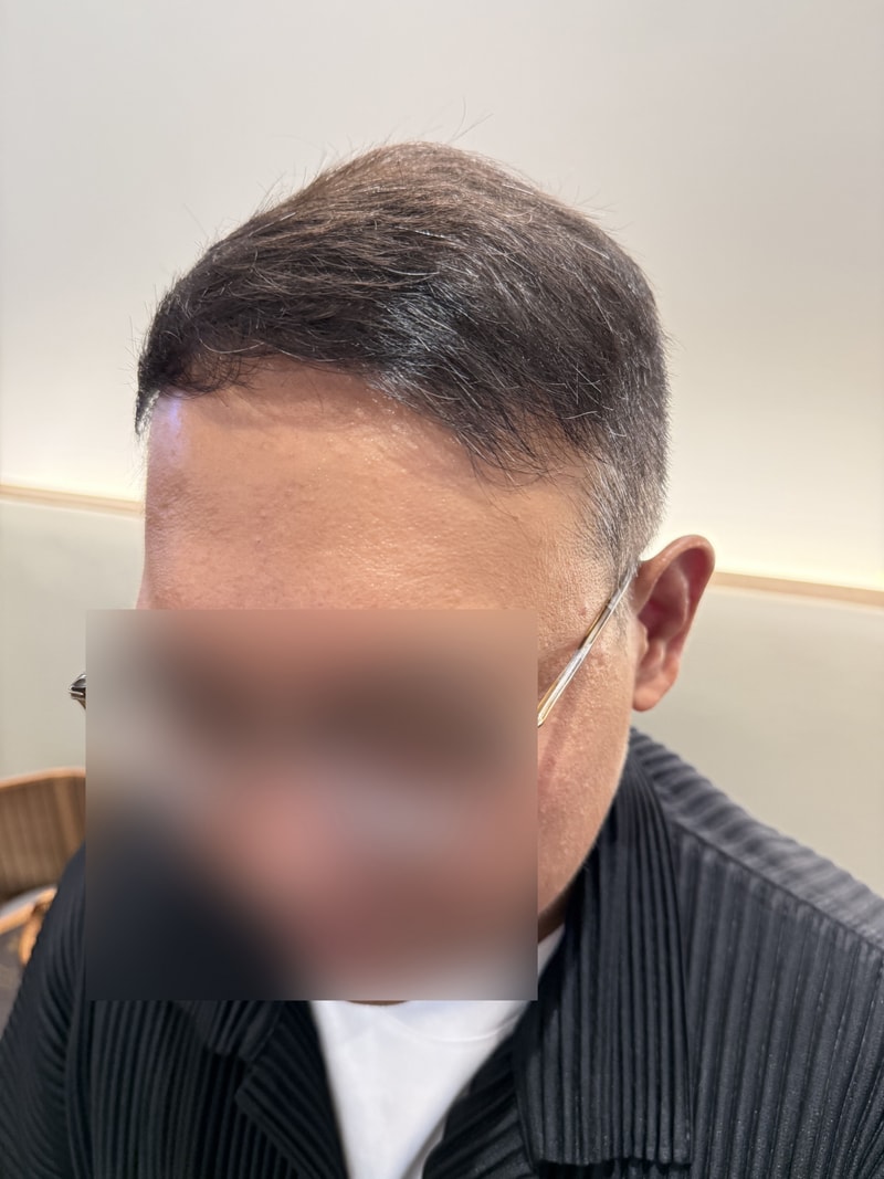 후3.jpg