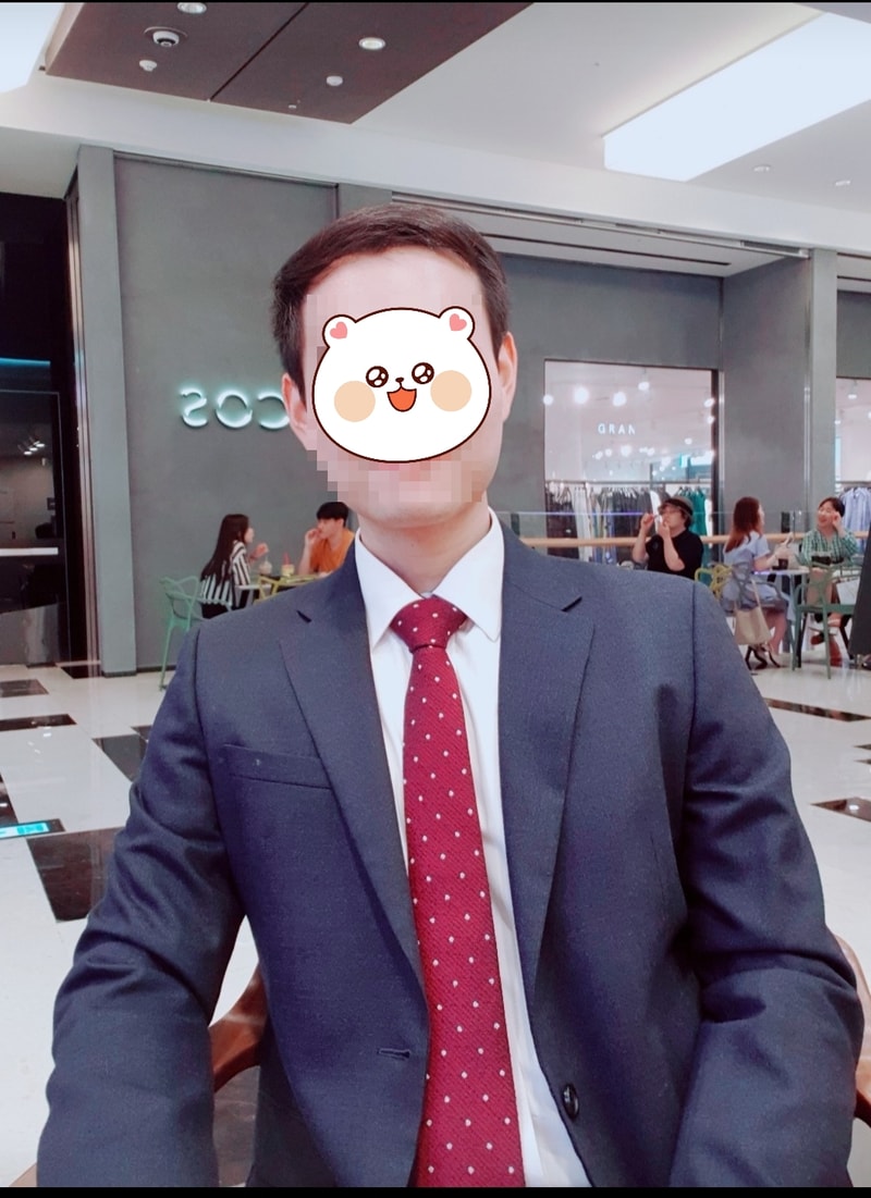 19.3.15 6 months after incision 3000 hair surgery.