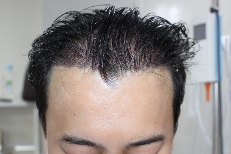 수술직후 1.jpg